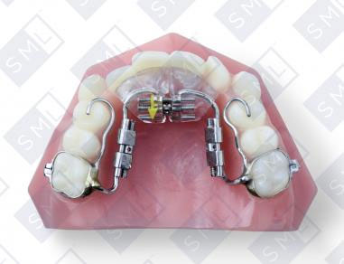 Fixed-3-Way-Sagittal