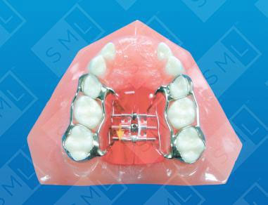 Haas-Suture-Expanding-Appliance