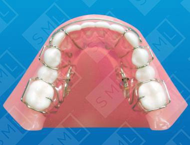 Lower-Molar-Distalizing-Sagittal