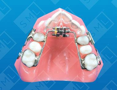 Magill-Sagittal-to-Distalize