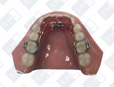 mandibular-gordon